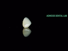 सिरेमिक क्राउन ब्रिज