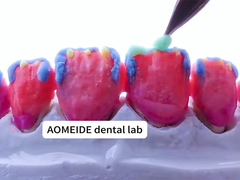 ताकत प्राकृतिक सौंदर्यशास्त्र ठोस जिरकोनिया मुकुट एकल या कई दांतों के लिए एकदम सही फिट