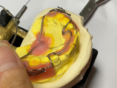 अनुकूलन के साथ अच्छा प्रतिधारण और समायोज्य सुविधाओं के साथ कस्टम निर्मित ऑर्थोडॉन्टिक उपकरण