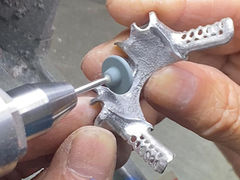 कास्ट आंशिक दांत