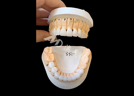 खरीदें एकल / बहु इकाई स्थिर बहाली के लिए बढ़ाया पारदर्शिता Zirconia दंत मुकुट online manufacture