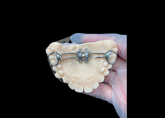 खरीदें दंतों के प्रभावी संरेखण के लिए एमएसई palatal expander अभिनव Orthodontic उपकरण online manufacture