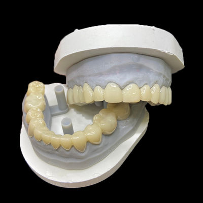 खरीदें PMMA Temporary Restorations CAD/CAM PMMA Crowns and Bridges for Provisional Dental Cases online manufacture