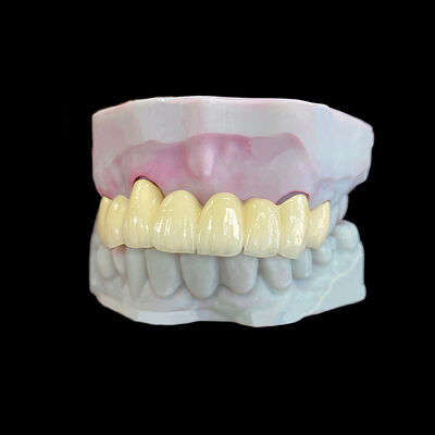 खरीदें को-सीआर फ्रेम के साथ धातु में पिघला हुआ चीनी मिट्टी (पीएफएम) मुकुट online manufacture