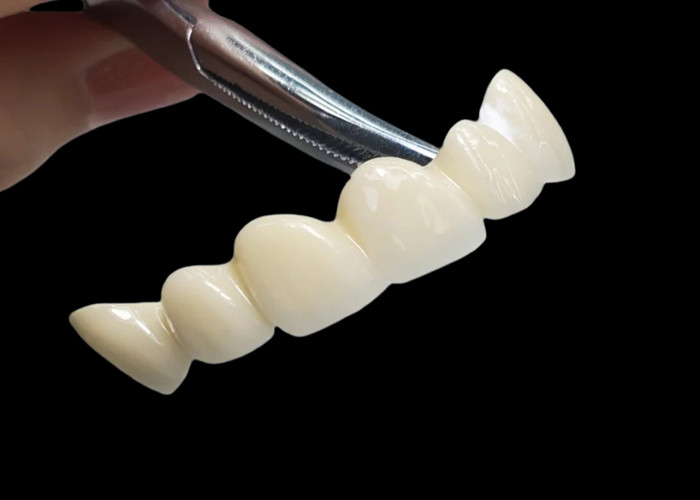 कस्टम पारदर्शी Zirconia दंत मुकुट उच्च स्थायित्व के साथ चीन दंत प्रयोगशाला से दाग प्रतिरोधी