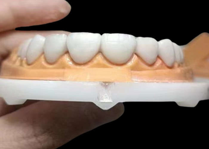 कस्टम पारदर्शी Zirconia दंत मुकुट उच्च स्थायित्व के साथ चीन दंत प्रयोगशाला से दाग प्रतिरोधी