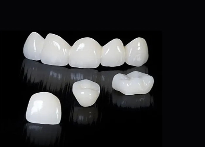 कस्टम पारदर्शी Zirconia दंत मुकुट उच्च स्थायित्व के साथ चीन दंत प्रयोगशाला से दाग प्रतिरोधी