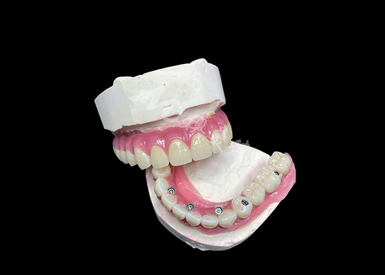 अच्छी कीमत Zirconia दंत प्रत्यारोपण क्राउन ब्रिज सभी 6 पर खो दांत प्रतिस्थापन के लिए ऑनलाइन