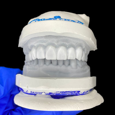 अच्छी कीमत Diagnostic Wax-Up for Porcelain Veneers ऑनलाइन