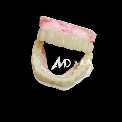अच्छी कीमत Lightweight PMMA Temporary Bridges with Hollow Design for Implant Restorations ऑनलाइन